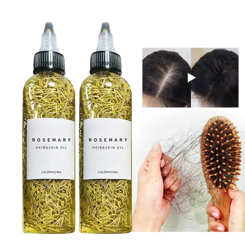 Rosemary Hair & Scalp Oil – Stronger, Fuller Hair Fast